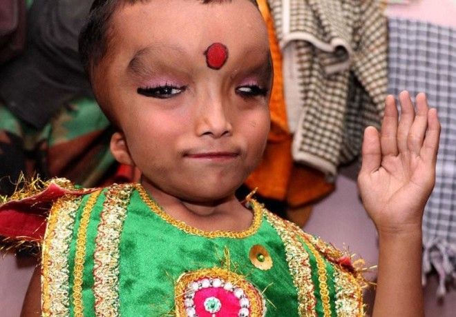 Жители индийской деревни поклоняются мальчику с деформированной головой как богу Ганеше 35