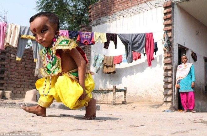 Жители индийской деревни поклоняются мальчику с деформированной головой как богу Ганеше 36