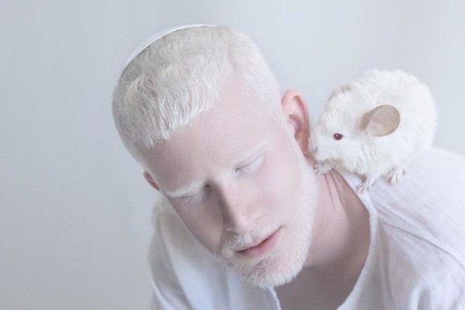 Фотограф показывает гипнотизирующую красоту людей-альбиносов (11 фото) 40