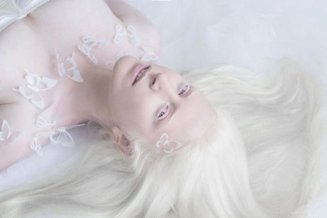 Фотограф показывает гипнотизирующую красоту людей-альбиносов (11 фото) 34