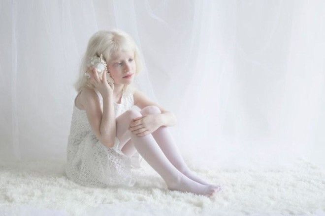 Фотограф показывает гипнотизирующую красоту людей-альбиносов (11 фото) 43