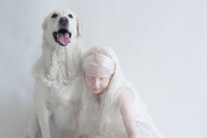 Фотограф показывает гипнотизирующую красоту людей-альбиносов (11 фото) 35