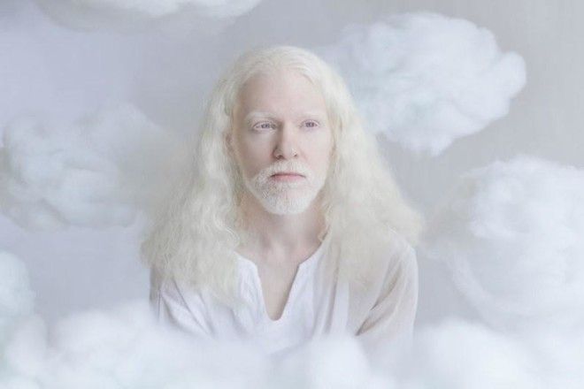 Фотограф показывает гипнотизирующую красоту людей-альбиносов (11 фото) 36
