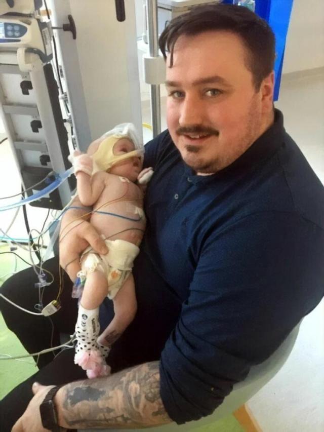 6-месячная малышка победила COVID-19, несмотря на проблемы с сердцем и лёгкими