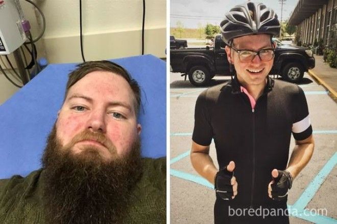 До и после: как меняется внешность человека, который перестает пить 42