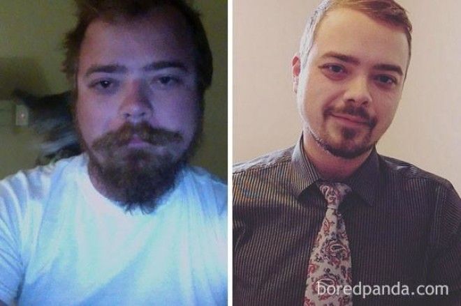 До и после: как меняется внешность человека, который перестает пить 43