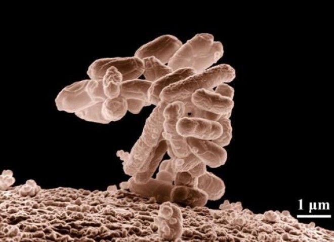 Самые опасные бактерии на Земле 28