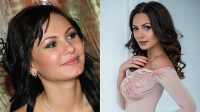 Одинаковые лица: Жены российских футболистов до и после пластики 19