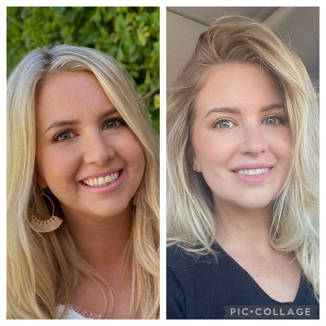 16 фотографий людей до и после того, как они решили исправить свою внешность с помощью пластической хирургии 60