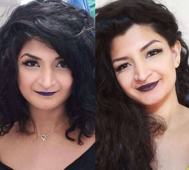 16 фотографий людей до и после того, как они решили исправить свою внешность с помощью пластической хирургии 62