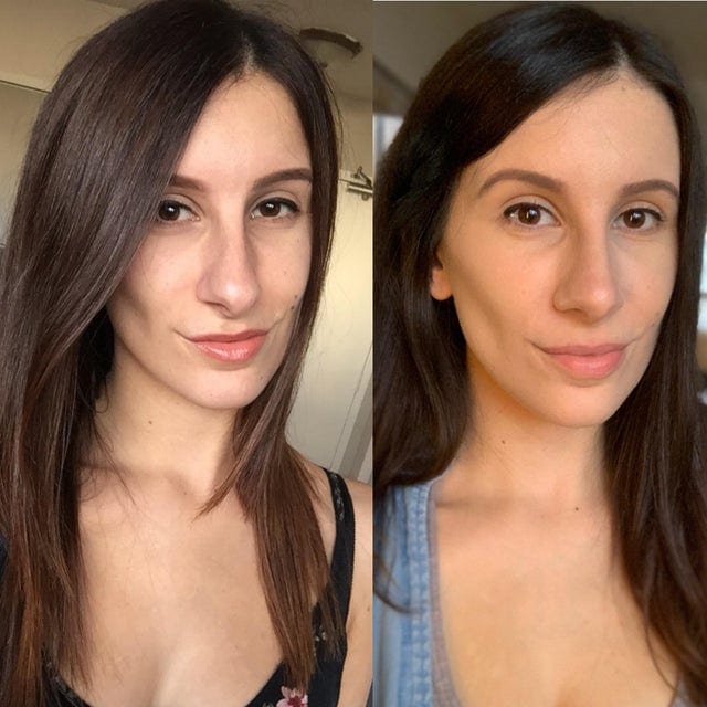 16 фотографий людей до и после того, как они решили исправить свою внешность с помощью пластической хирургии 67