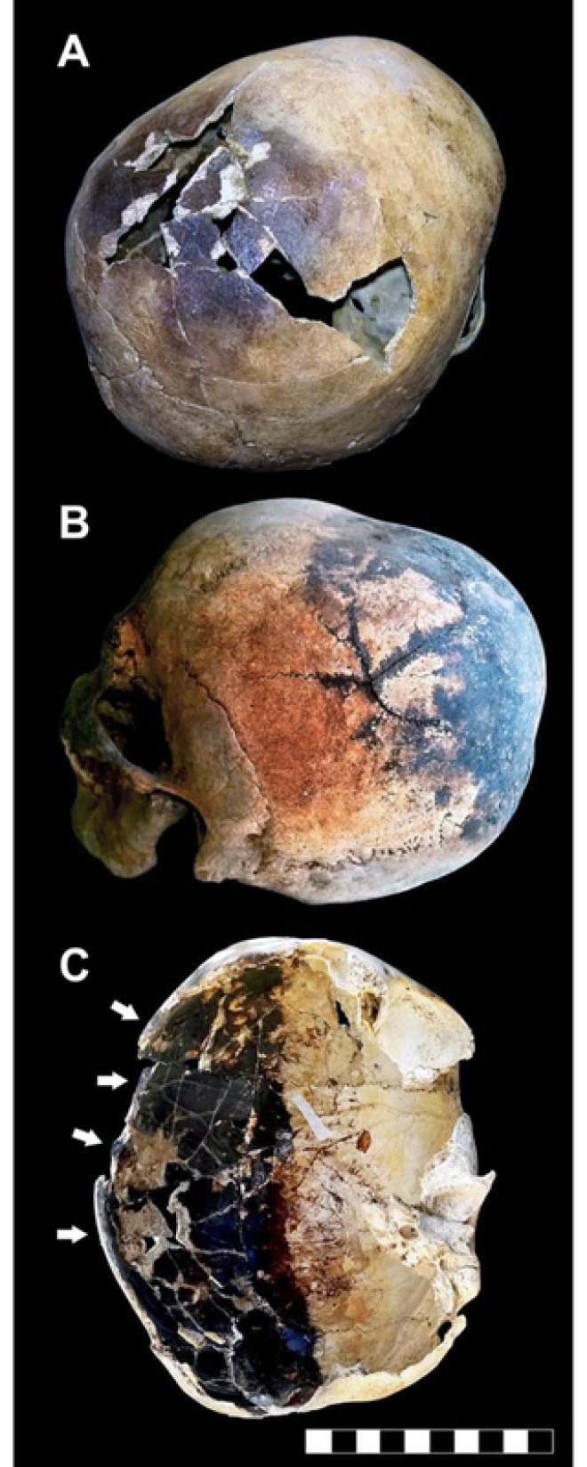 Крики и закипающая кровь: археологи рассказали, как умирали жители Помпеи 16