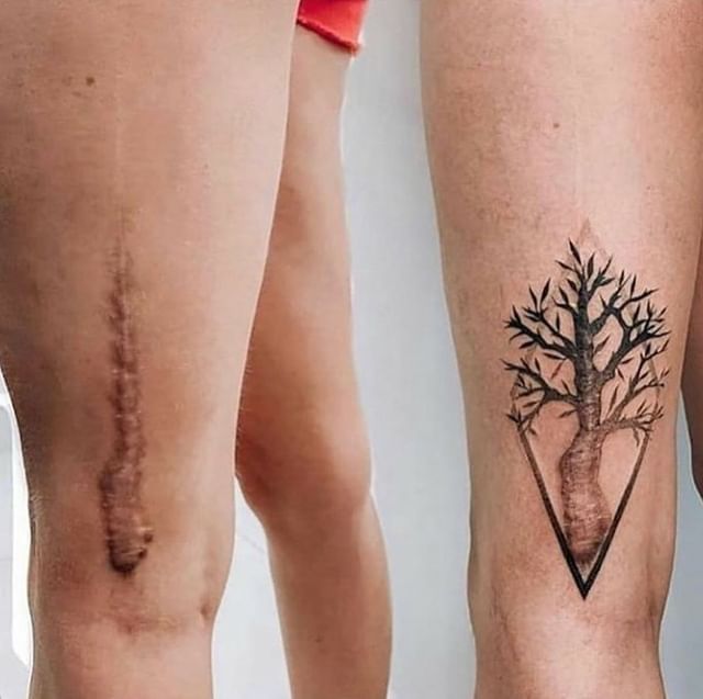 16 случаев, когда люди с помощью татуировок оригинально скрыли или обыграли свои шрамы и родимые пятна 59