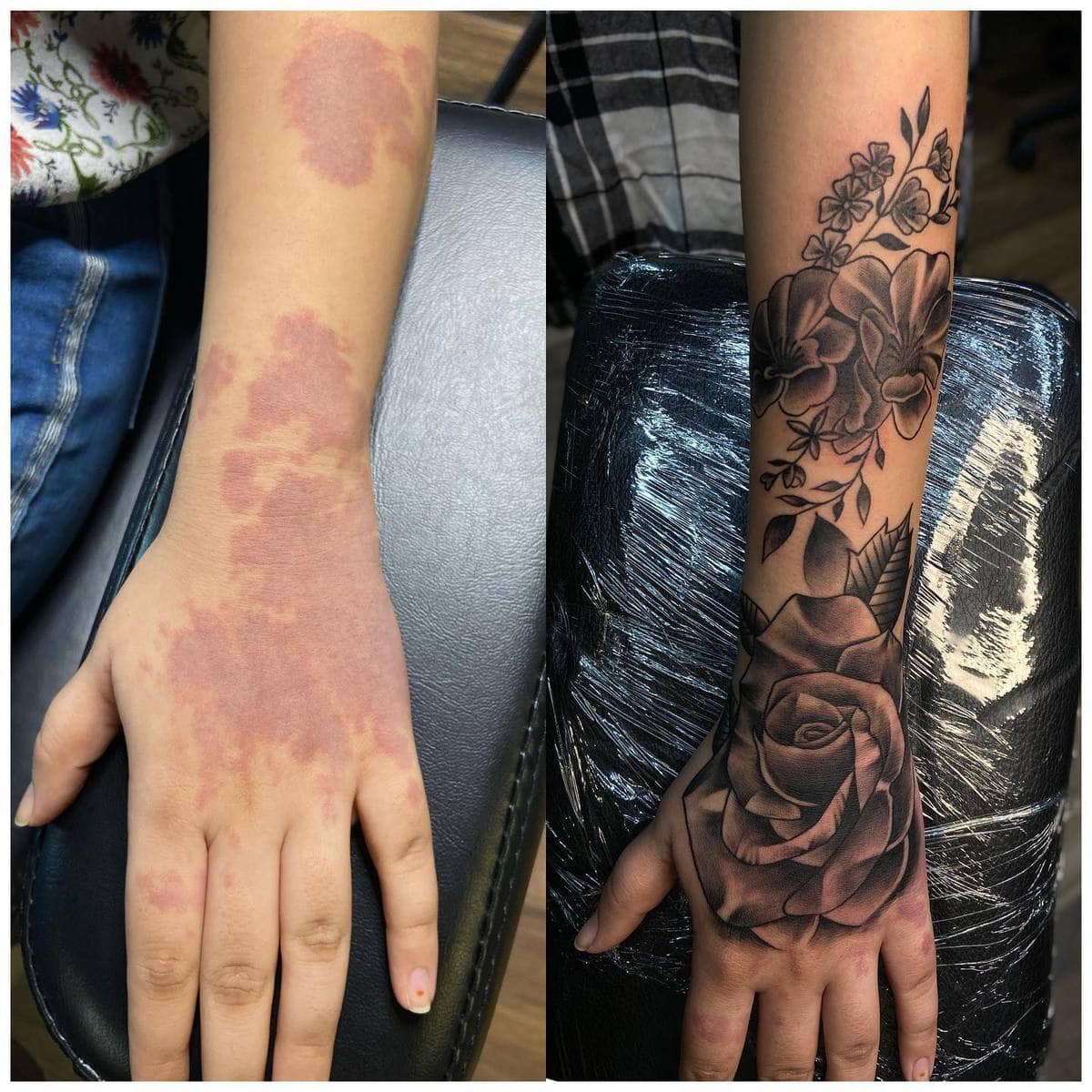 16 случаев, когда люди с помощью татуировок оригинально скрыли или обыграли свои шрамы и родимые пятна 52