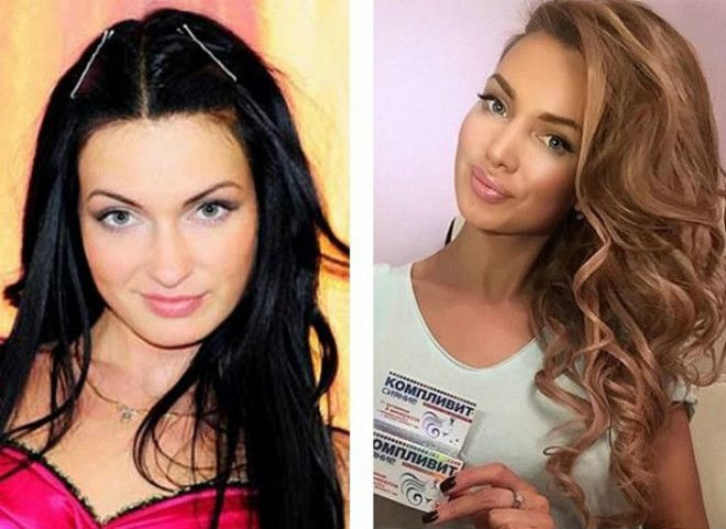 10 российских красавиц до и после пластики 40