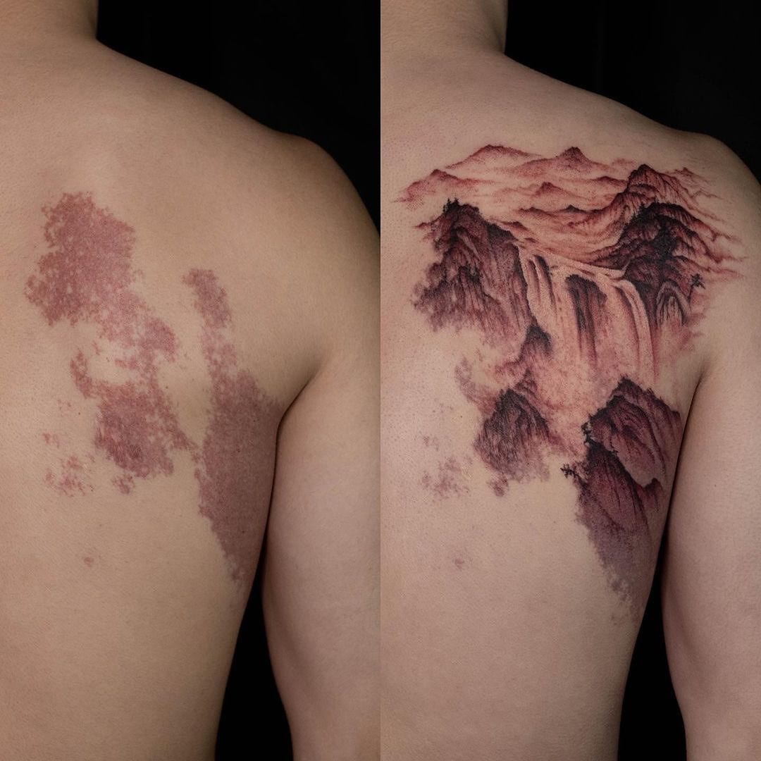 16 случаев, когда люди с помощью татуировок оригинально скрыли или обыграли свои шрамы и родимые пятна 56