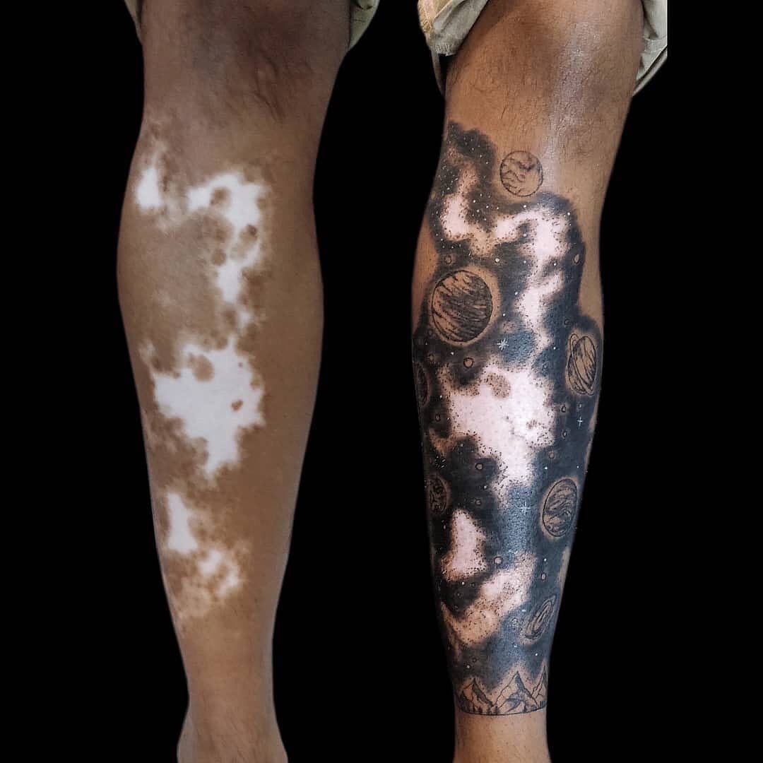 16 случаев, когда люди с помощью татуировок оригинально скрыли или обыграли свои шрамы и родимые пятна 64