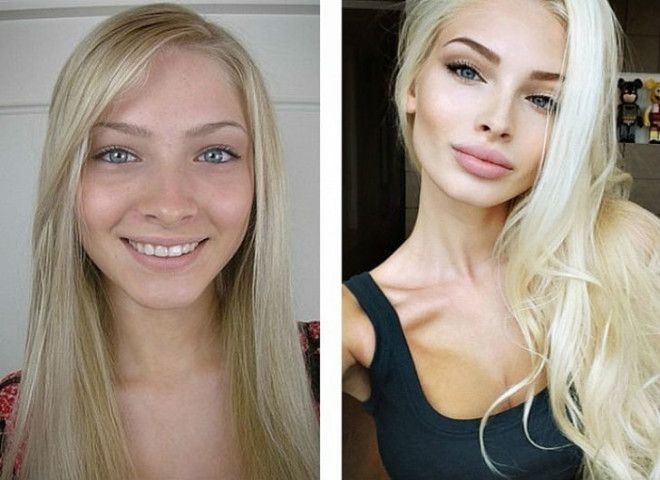 10 российских красавиц до и после пластики 31
