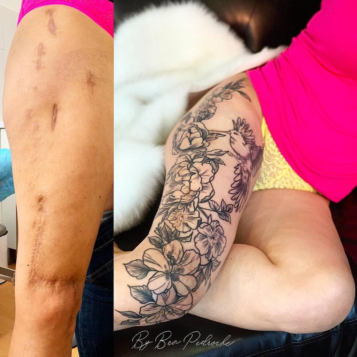 16 случаев, когда люди с помощью татуировок оригинально скрыли или обыграли свои шрамы и родимые пятна 63