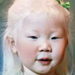 Как выглядят альбиносы разных национальностей и рас