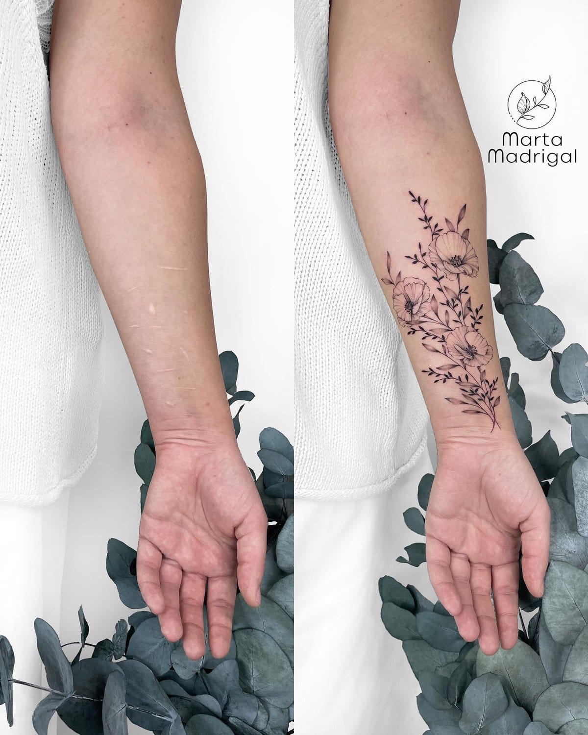 15 случаев, когда люди решили не прятать свои шрамы, а обыграть их с помощью татуировок 58