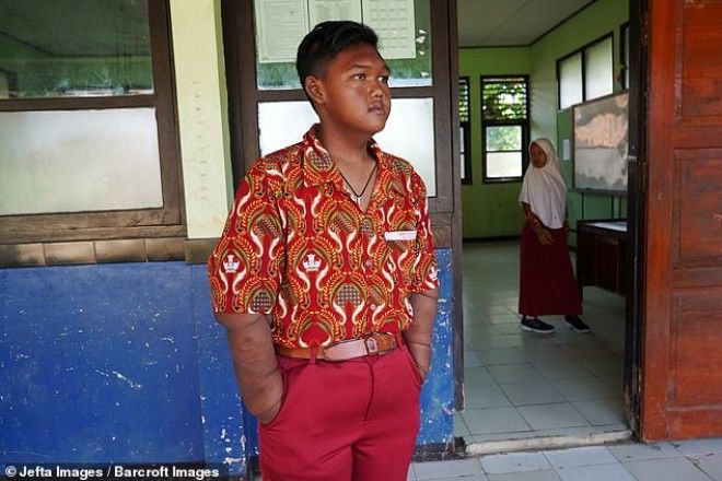 Самый толстый мальчик в мире, который весил 192 кг, похудел 40