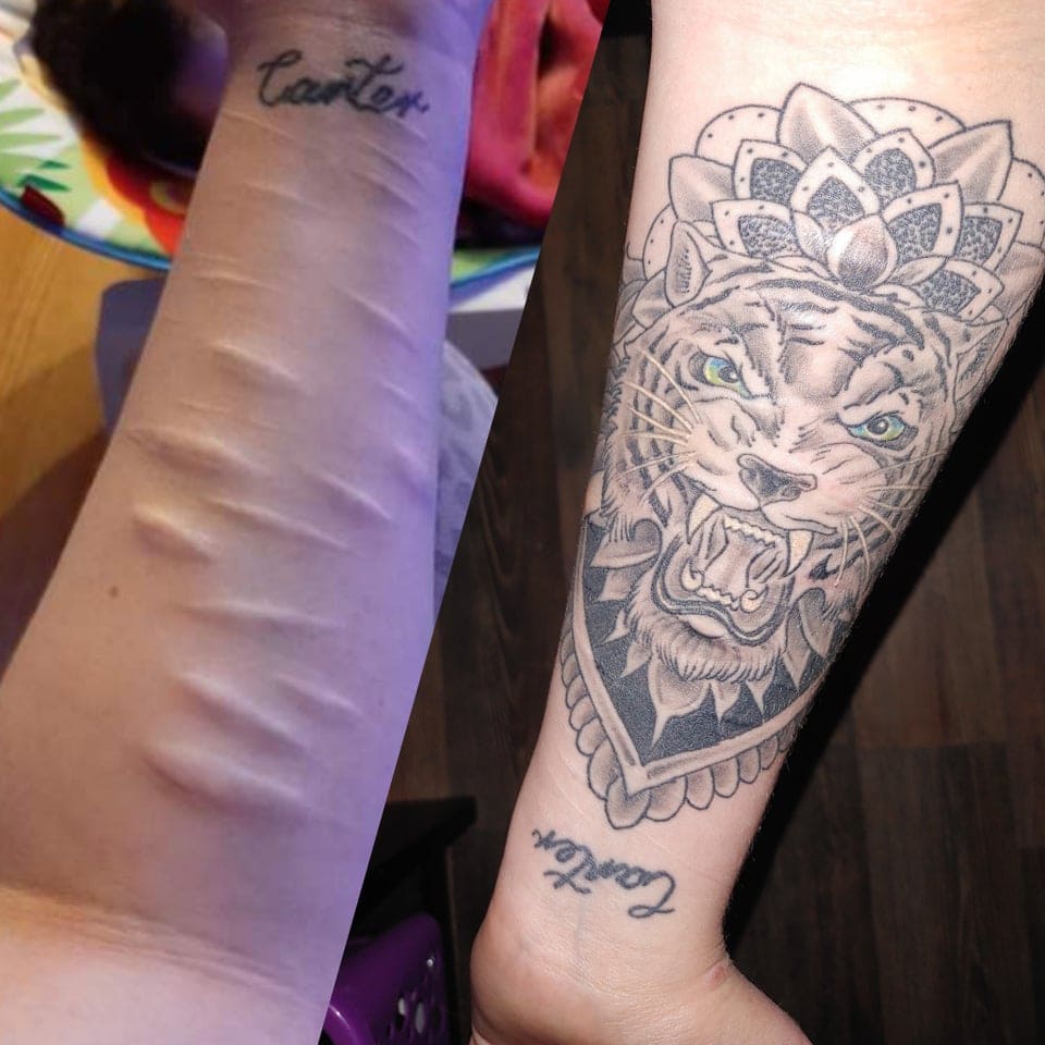 15 случаев, когда люди решили не прятать свои шрамы, а обыграть их с помощью татуировок 51
