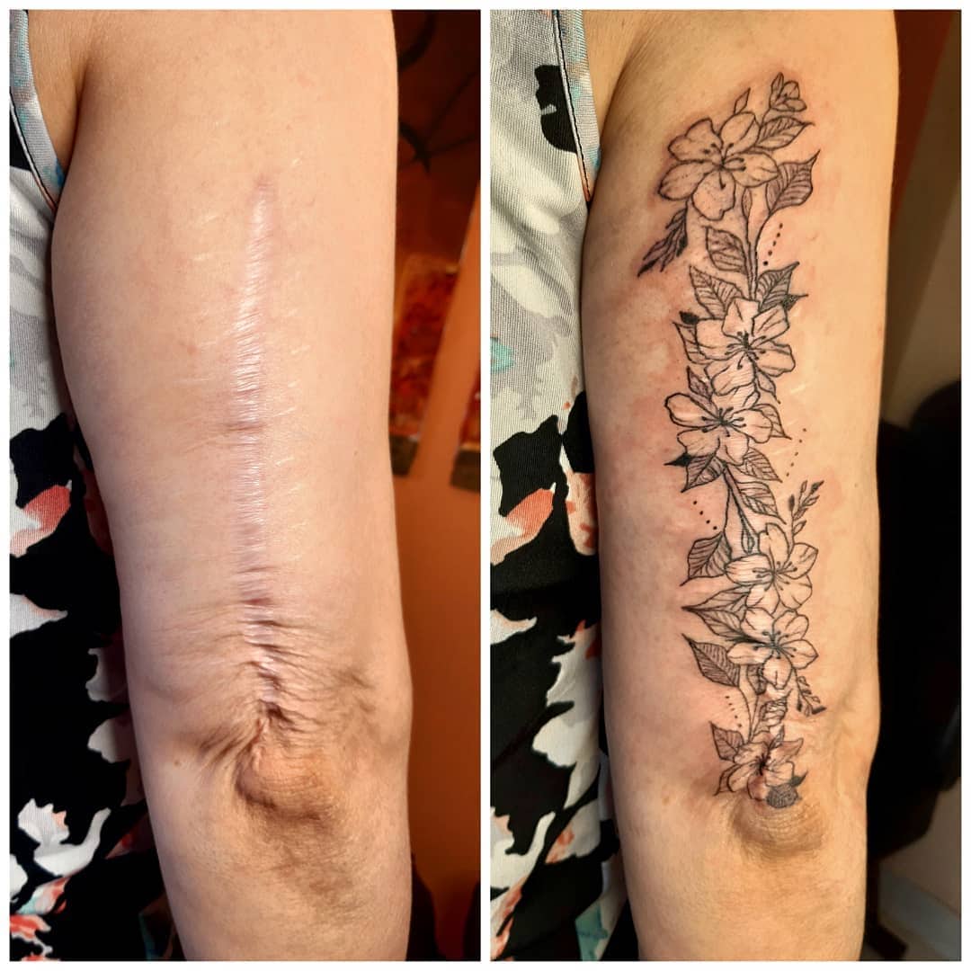 15 случаев, когда люди решили не прятать свои шрамы, а обыграть их с помощью татуировок 46