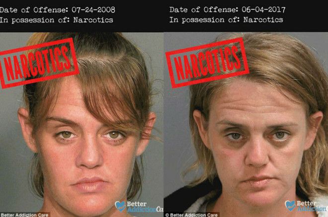 Лица наркозависимых до и после: как запрещенные вещества влияют на внешность 22