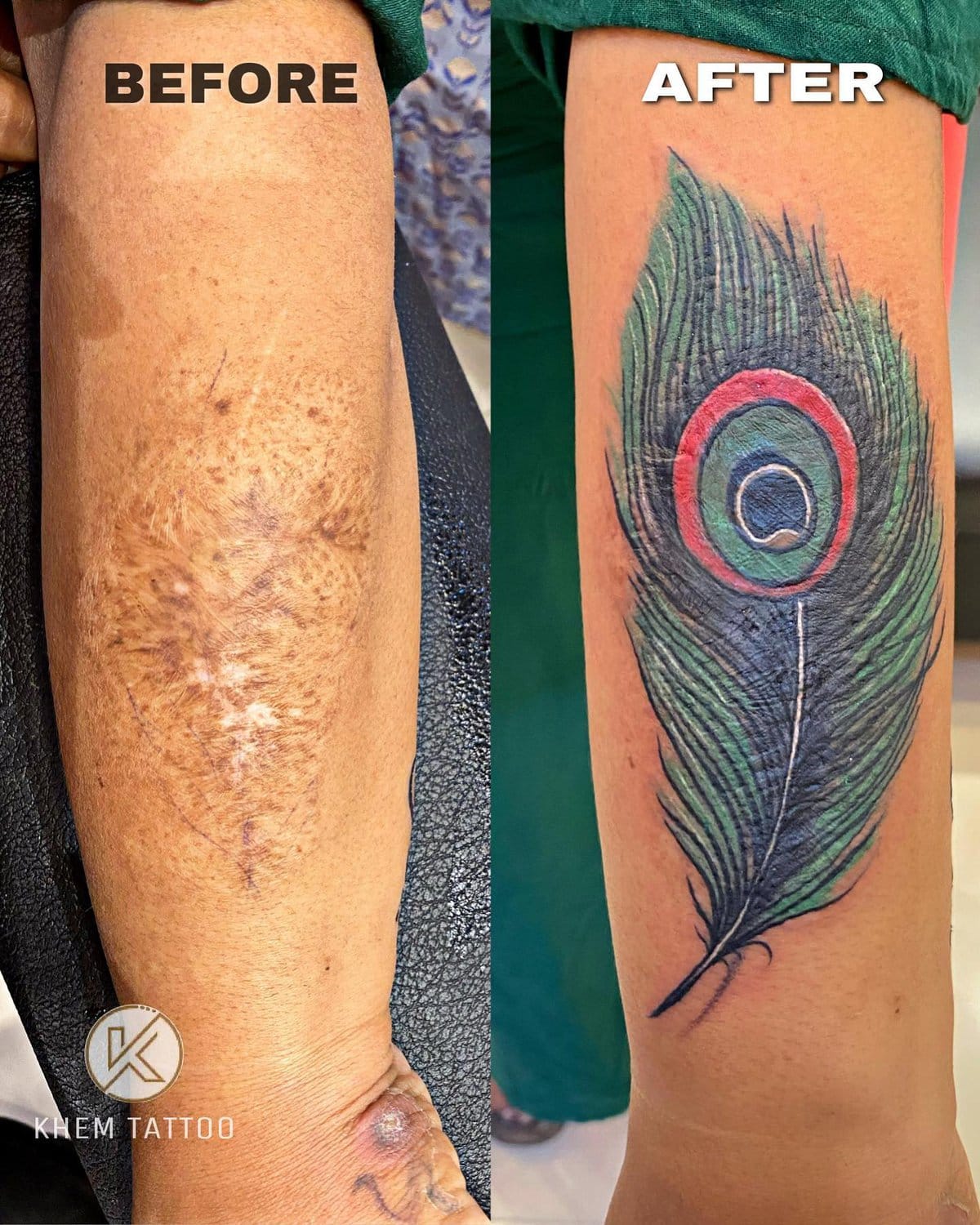 15 случаев, когда люди решили не прятать свои шрамы, а обыграть их с помощью татуировок 48