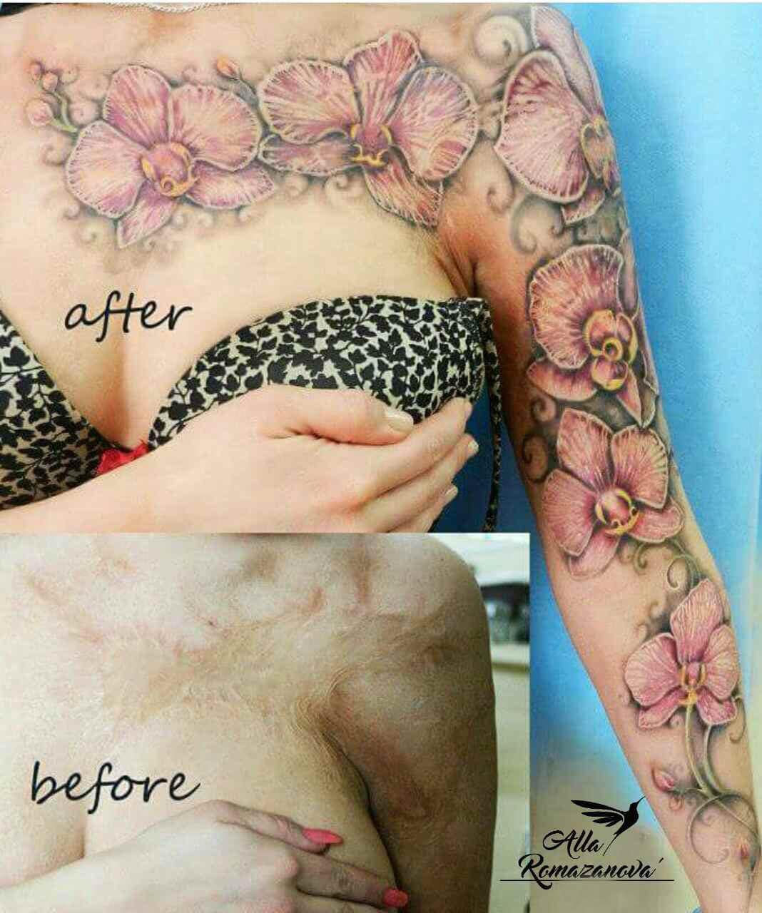 15 случаев, когда люди решили не прятать свои шрамы, а обыграть их с помощью татуировок 50