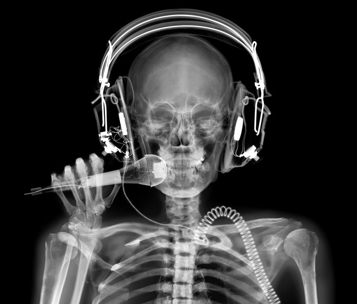 18 занятных рентгеновских снимков, которые позволят взглянуть на привычные вещи с другой стороны 58