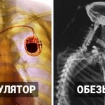 18 занятных рентгеновских снимков, которые позволят взглянуть на привычные вещи с другой стороны