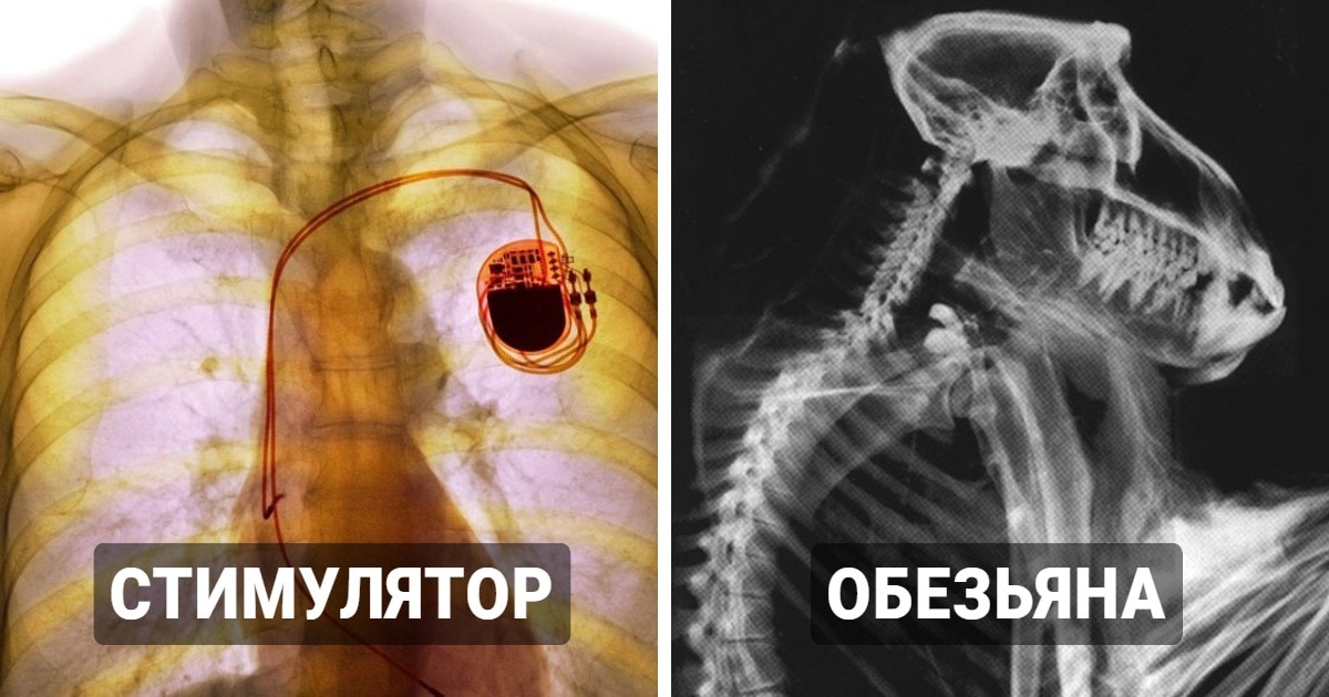 18 занятных рентгеновских снимков, которые позволят взглянуть на привычные вещи с другой стороны