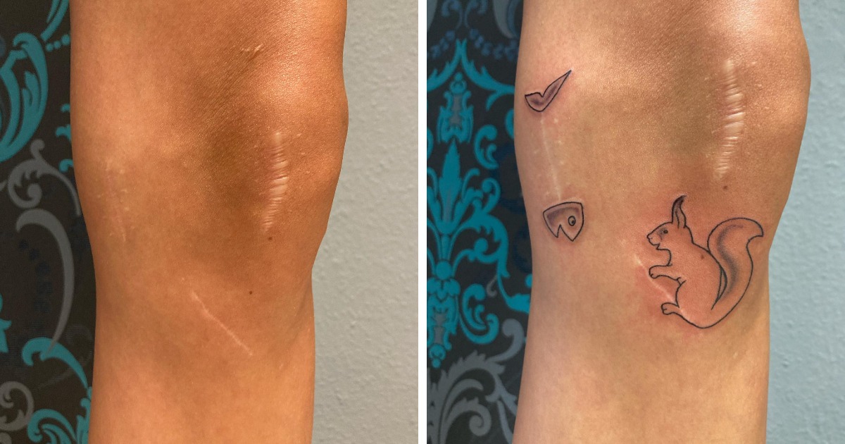 15 случаев, когда люди решили не прятать свои шрамы, а обыграть их с помощью татуировок 49
