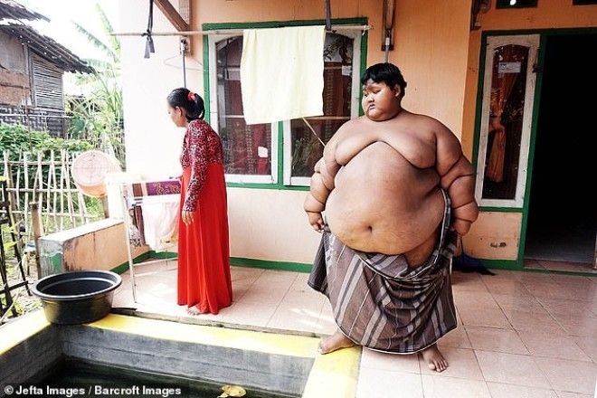 Самый толстый мальчик в мире, который весил 192 кг, похудел 34