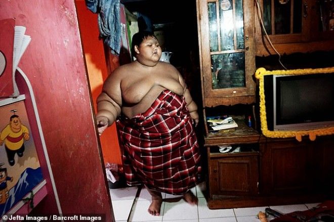 Самый толстый мальчик в мире, который весил 192 кг, похудел 38