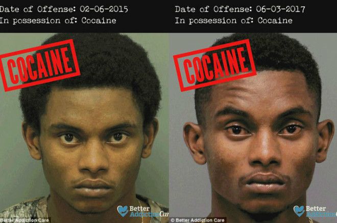 Лица наркозависимых до и после: как запрещенные вещества влияют на внешность 24