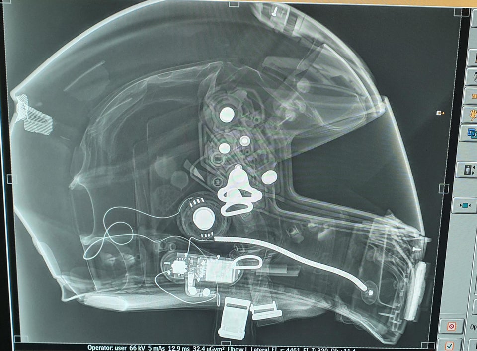 18 занятных рентгеновских снимков, которые позволят взглянуть на привычные вещи с другой стороны 70