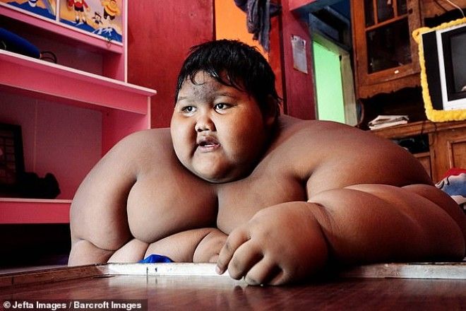 Самый толстый мальчик в мире, который весил 192 кг, похудел 35