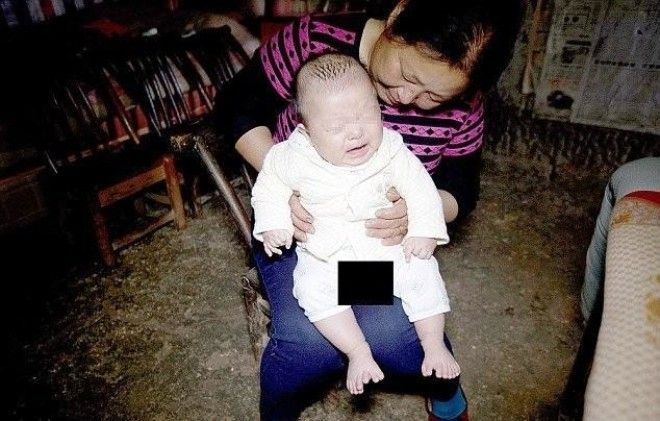 В Китае родился мальчик у которого 31 палец 16