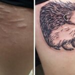 15 татуировок, которые превратили шрамы в произведения искусства