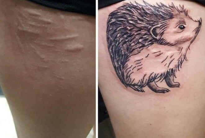 15 татуировок, которые превратили шрамы в произведения искусства
